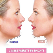 Facial Slimming Belt | Reusable V-Shape Face Lift & Double Chin Reducer Mask for Men & Women (1 Pc) Top Trendy Essentials