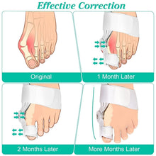 Silicone Toe Separator For Adults Bunion Corrector Splint Kit For Toe 4nmtwe-ev