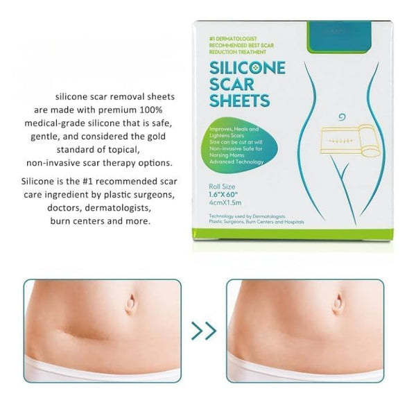 Reusable Silicone Scar Removal Tape | Medical-Grade Sheets for C-Section, Acne & Surgical Scars Top Trendy Essentials