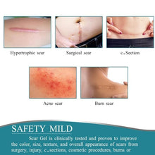 Reusable Silicone Scar Removal Tape | Medical-Grade Sheets for C-Section, Acne & Surgical Scars Top Trendy Essentials