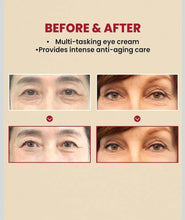 SEOUL 1988 Eye Cream K with Retinal Liposome 4% & Fermented Bean | Anti-Aging & Brightening (30ml) Top Trendy Essentials