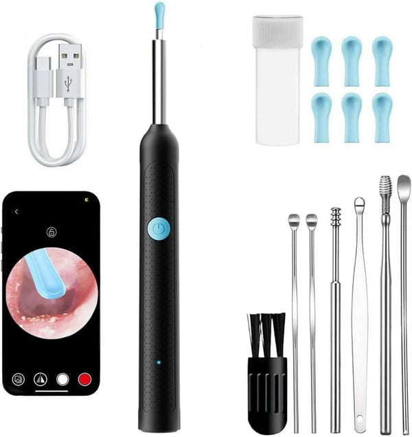 Ear Cleaner Tool with HD Camera & LED Light – Smart Otoscope Kit Top Trendy Essentials