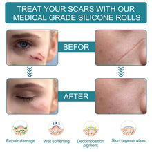 Reusable Silicone Scar Removal Tape | Medical-Grade Sheets for C-Section, Acne & Surgical Scars Top Trendy Essentials