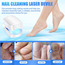 Rechargeable Nail Fungus Treatment