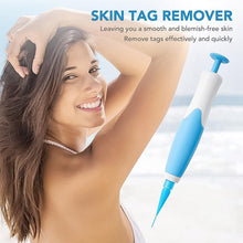 Skin Tag Remover Kit 2 In 1 For Micro To Large (2 Mm - 8 Mm  1 Set) Wukusy
